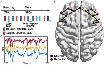 The characteristics of brain network in patient with post-stroke depression under cognitive task condition